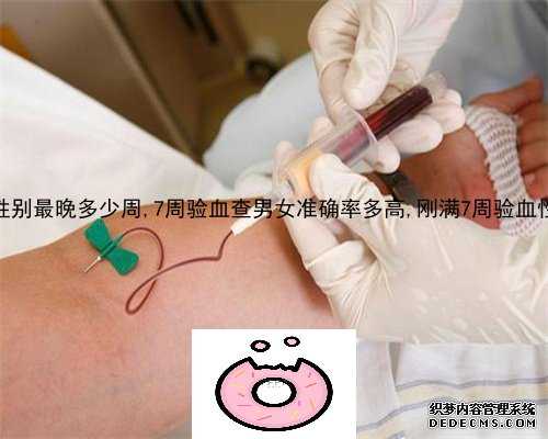 十二周验血查胎儿性别准确吗_香港验血诊所会先B超吗_准不准知道的来说说