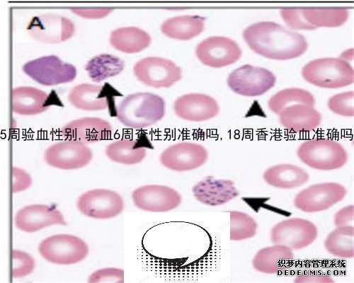 9周了还能香港验血吗_香港公认的验血机构_亲身经历详细攻略!