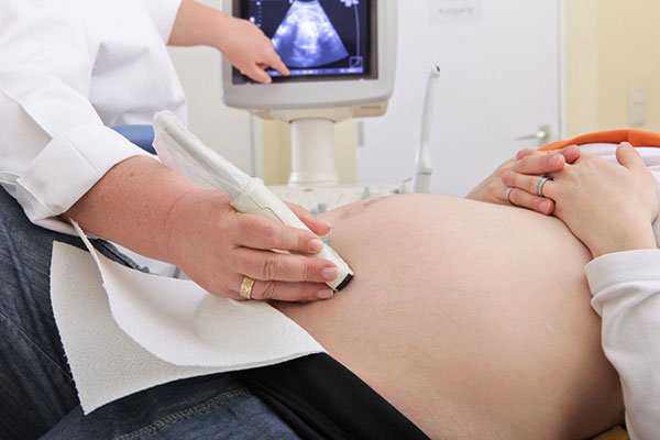 三个月胎儿彩超怎么分辨男女，孕妇如何快速知道胎